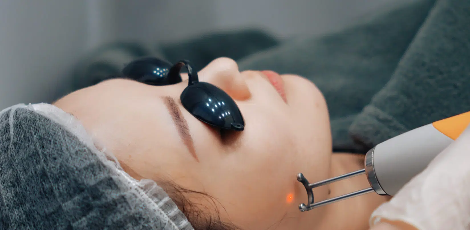 pico laser treatment