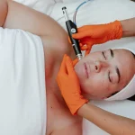 The Benefits of Custom Acne Treatments Designed for Your Unique Skin