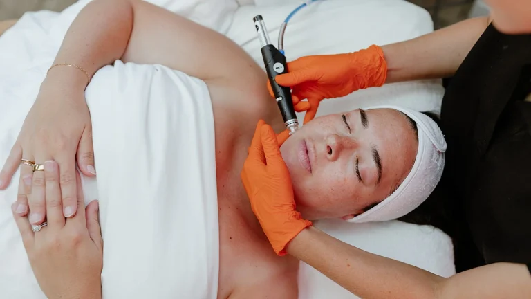 The Benefits of Custom Acne Treatments Designed for Your Unique Skin