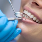 Great Gains with General Dentistry: Gentle Gum Guidance and Giggling Smiles