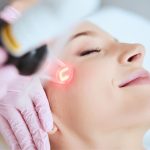 Safe and Effective Pico Laser Treatment: Choosing the Best Clinic for Your Skin